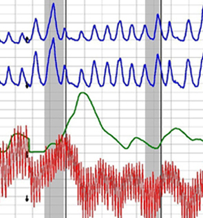 chart from a Lancaster polygraph
